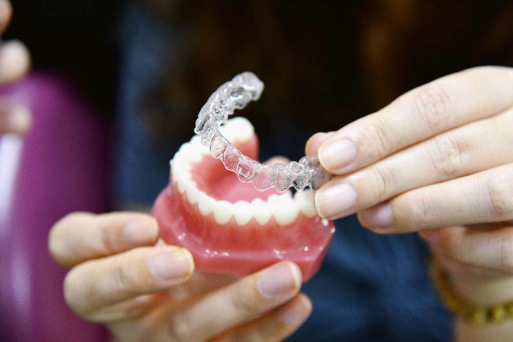 invisalign clear aligner with jaw model | invisalign kalaheo