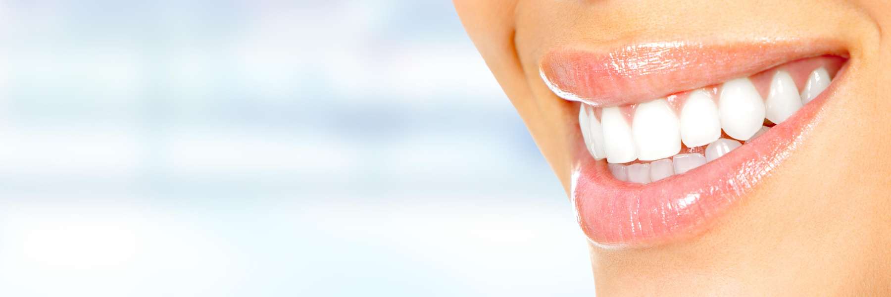 close up of bright patient smile | cosmetic dentist kalaheo