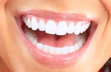A woman with white teeth smiling | teeth whitening Kalaheo