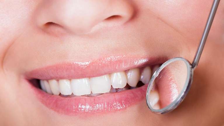 patient with bright smile and dental tool | veneers kauai