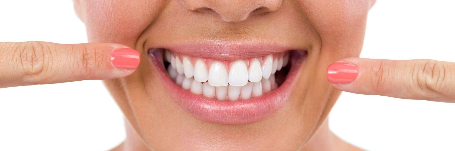 close up of bright smile | straight teeth hawaii