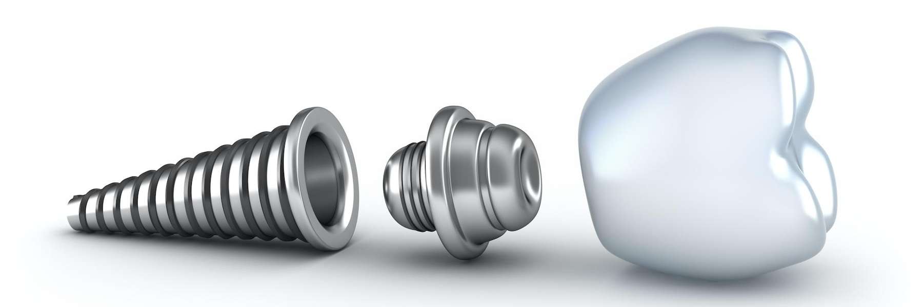dental implant and screw | dental implants near lawai